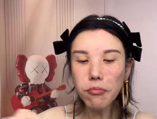 多大网红拍摄吃播2年如今脸部严重变形爱游戏(ayx)吃播对身体的危害有(图5)