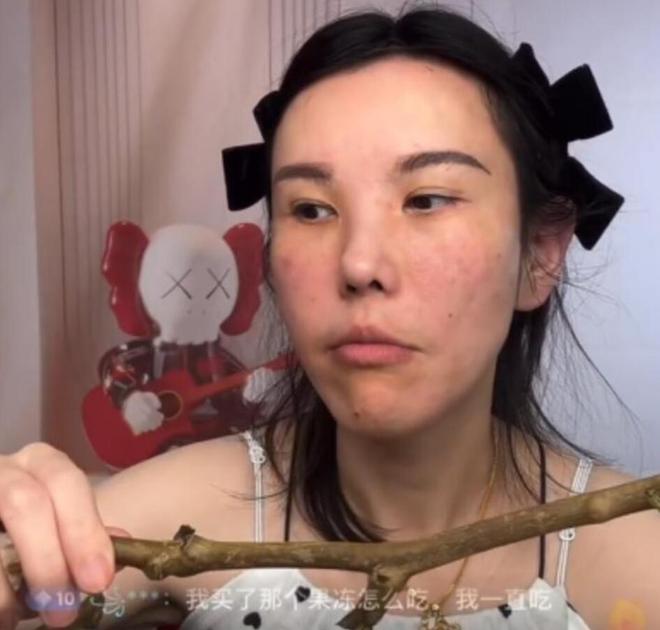 多大网红拍摄吃播2年如今脸部严重变形爱游戏(ayx)吃播对身体的危害有(图4)