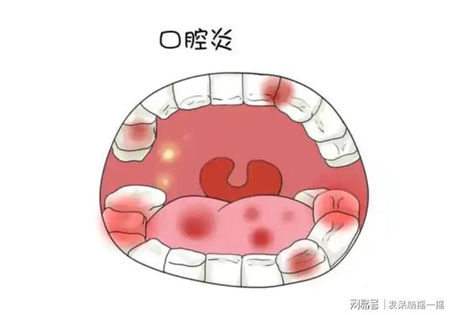 口水：口腔清洁组合拳该怎么打？爱游戏网站入口小鹿妈妈牙线与漱(图3)